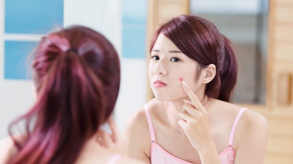 Alibaba, L’Oréal introduce new AI skin-testing tech for acne